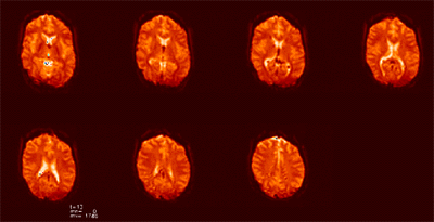 Brain fMRI